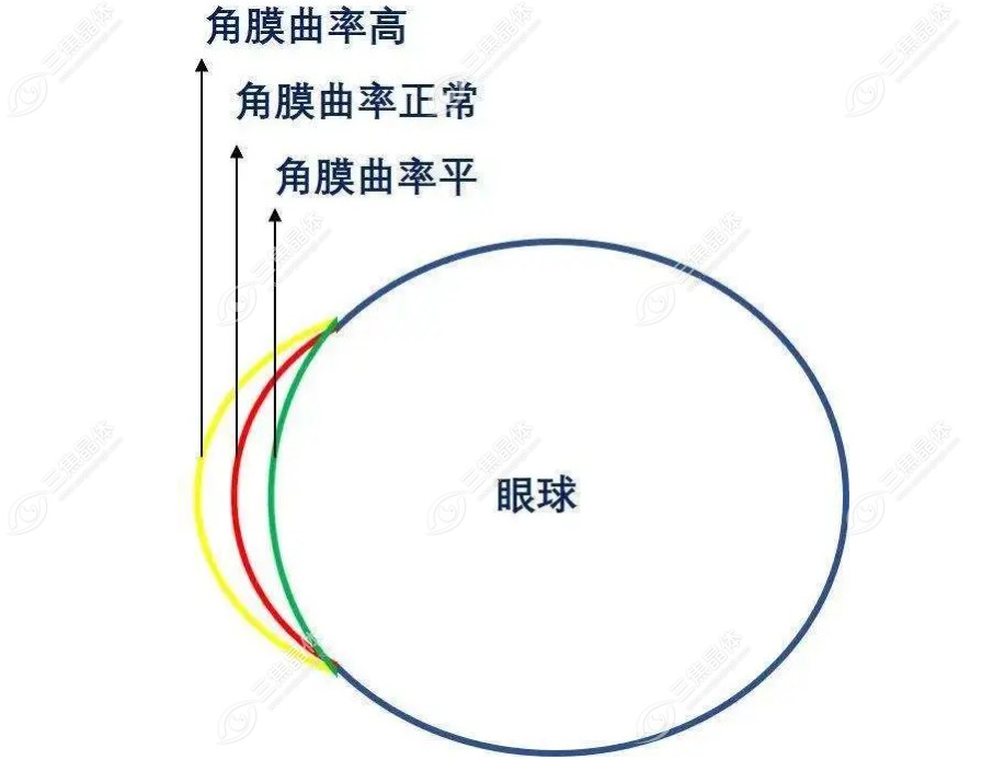 角膜曲率k1,k2差值正常范围是多少www.sanjiaojingti.com