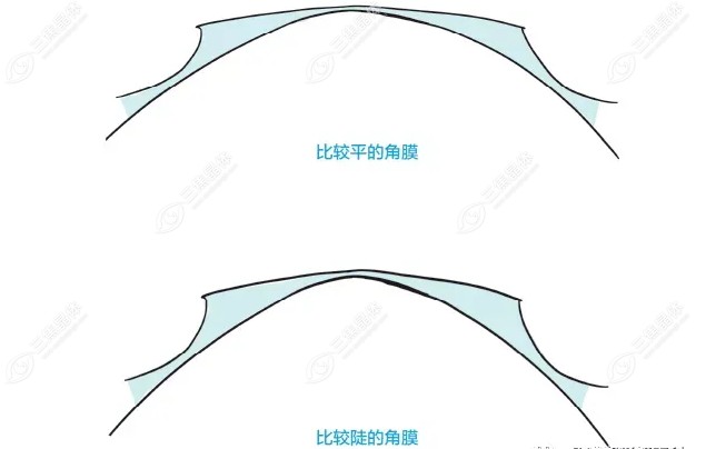 角膜曲率k1,k2差值和近视的关系~三焦晶体
