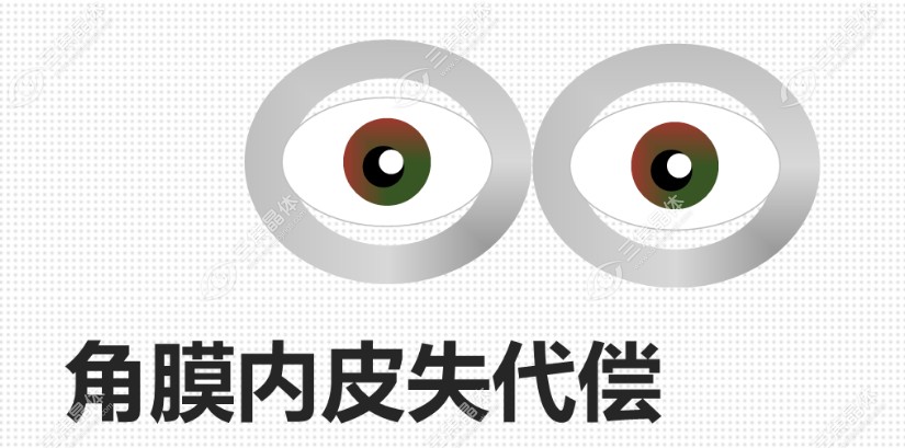 角膜内皮失代偿www.sanjiaojingti.com