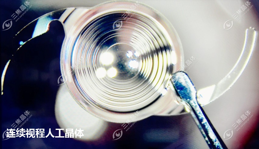 连续视程人工晶体的优点:可以看很远,比三焦点人工晶体好