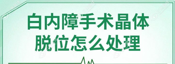 晶状体移位对视力的影响有哪些