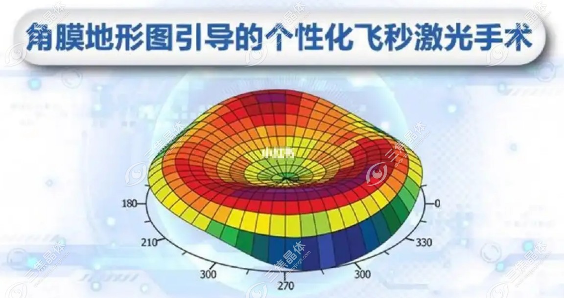个性化半飞秒会比半飞秒切的角膜少