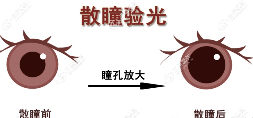 散瞳验光后可以直接配镜吗?不可以