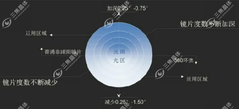 有散光的孩子戴离焦镜片好吗?好呀