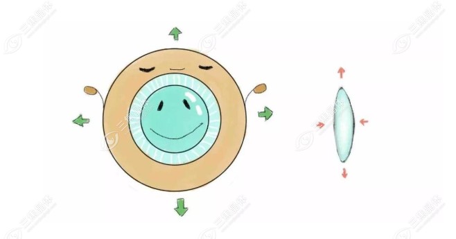 晶体脱落需要马上手术吗