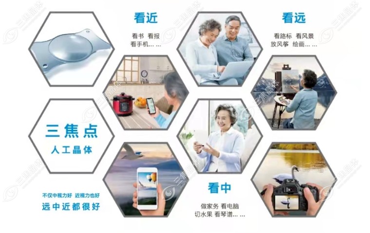 三焦晶体植入手术费用在：30000-60000元左右