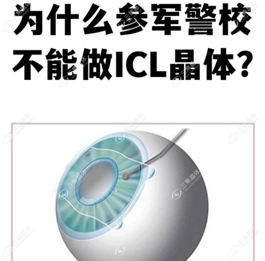 做晶体植入近视眼手术能当兵吗?不能/可以选飞秒激光类手术