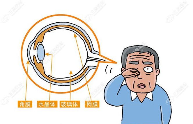 晶状体浑浊是什么原因造成的