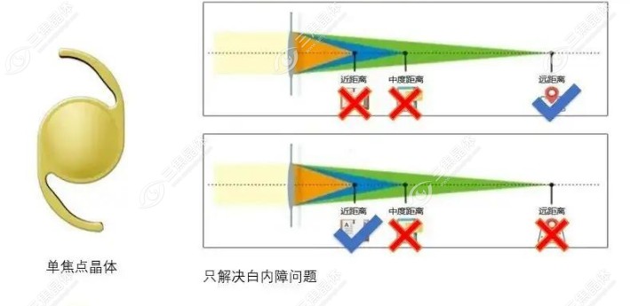 单焦晶体真的近的一点都看不清吗?不是