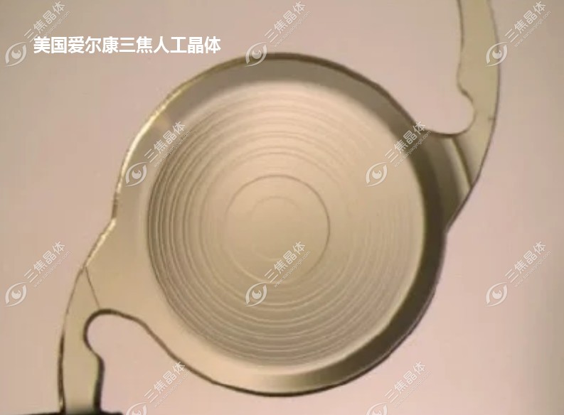 美国爱尔康三焦点人工晶体优点