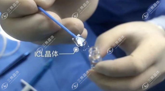 晶体植入度数不够可以再次做吗www.sanjiaojingti.com