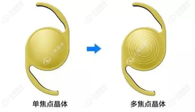 单焦晶体和双焦晶体哪个好一点?双焦晶体好