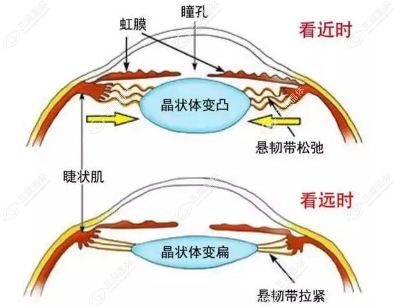 单焦晶体和双焦晶体价格差距