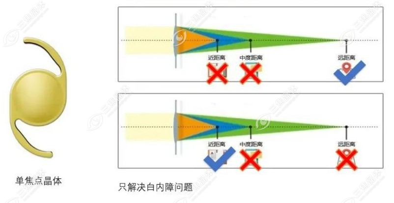 单焦晶体和双焦晶体哪个好一点?不考虑价格的话我会这样选