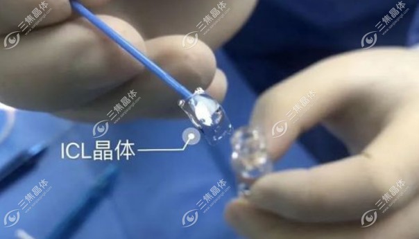 爱尔眼科晶体植入手术多少钱?3-3.5万元起
