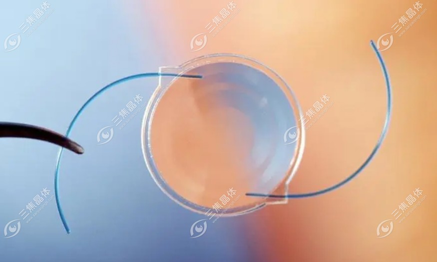强生视力康人工晶体价格从2000-12000元左右不等