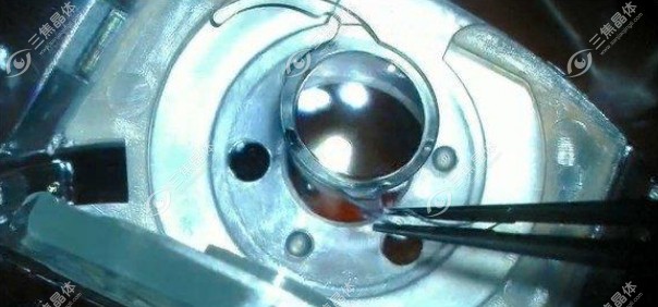 人工晶体眼力健Za9003的切口2.8-3.2mm左右