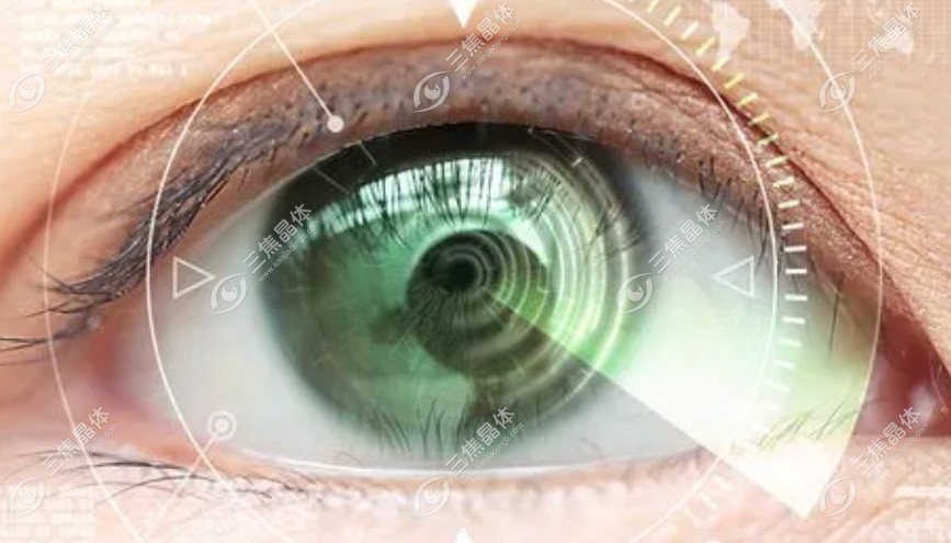 强生视力康人工晶体有几种型号？4种