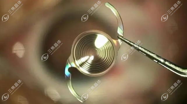 softechdo人工晶体