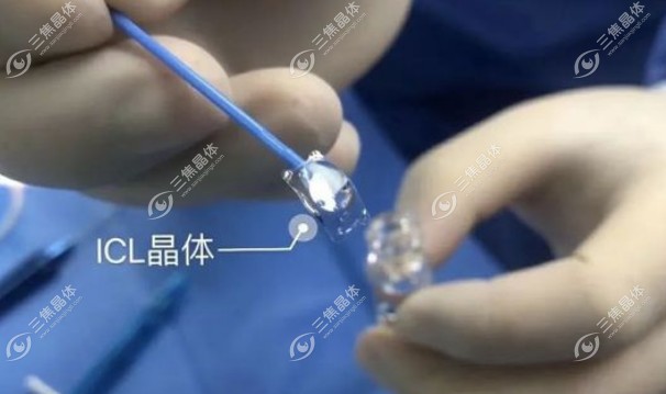 icl晶体八年后取出惊人的发现:虽视力回退但眼底竟完好如初
