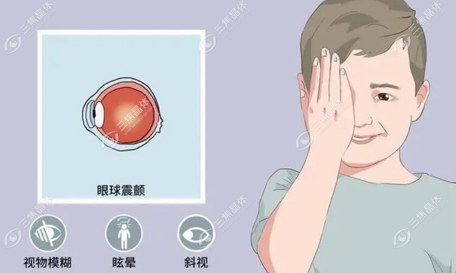 杨东生治疗眼球震颤是真的吗?真的,要约来上海普瑞眼科挂号