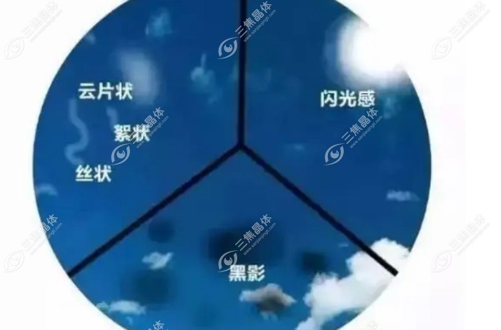 后发障激光后有漂浮物正常吗？正常