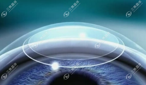 全飞秒暗瞳直径要求www.sanjiaojingti.com