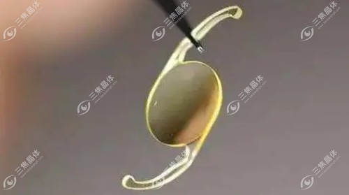 白内障晶体价格高低，可选择的晶体种类不同