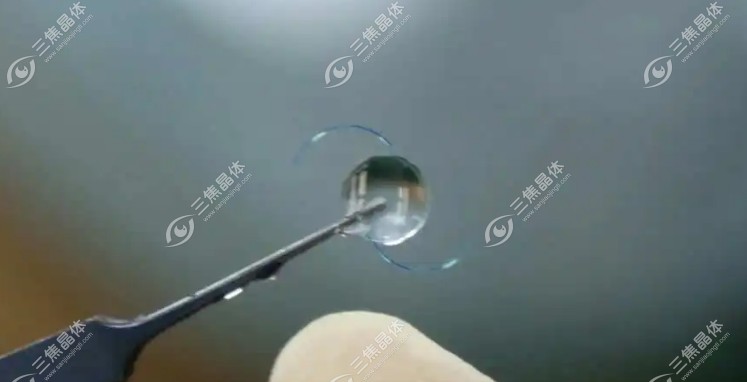 白内障晶体价格高低有什么区别www.sanjiaojingti.com