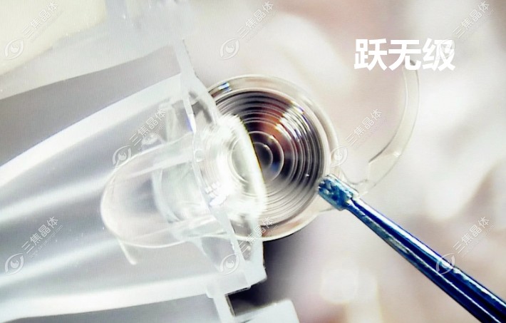 跃无级人工晶体#三焦晶体
