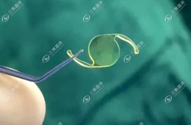 三焦人工晶体介绍