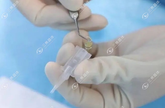 选择具有蓝光过滤功能的晶体是保护视网膜健康的重要措施