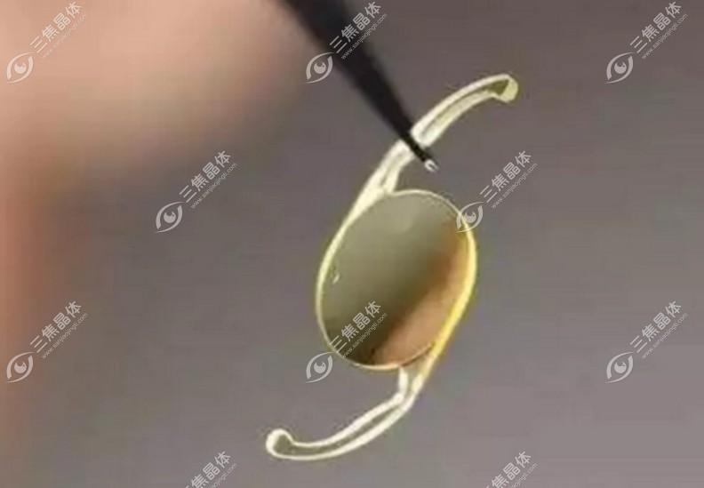 德国人类光学diff-aay人工晶体是后房型人工晶体~三焦晶体