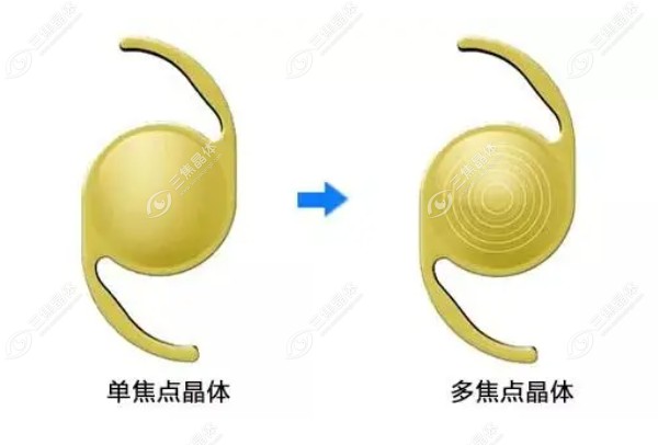 艾无极是多焦还是单焦晶体
