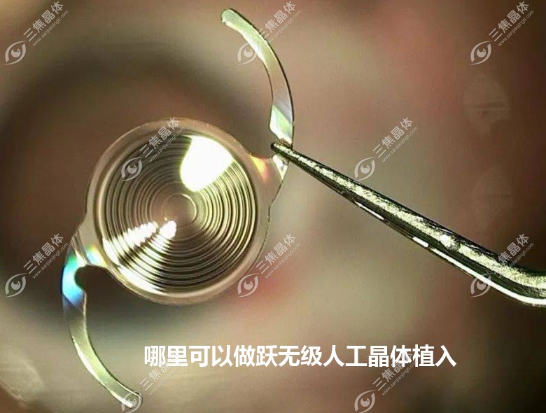 哪个医院可以做跃无级人工晶体