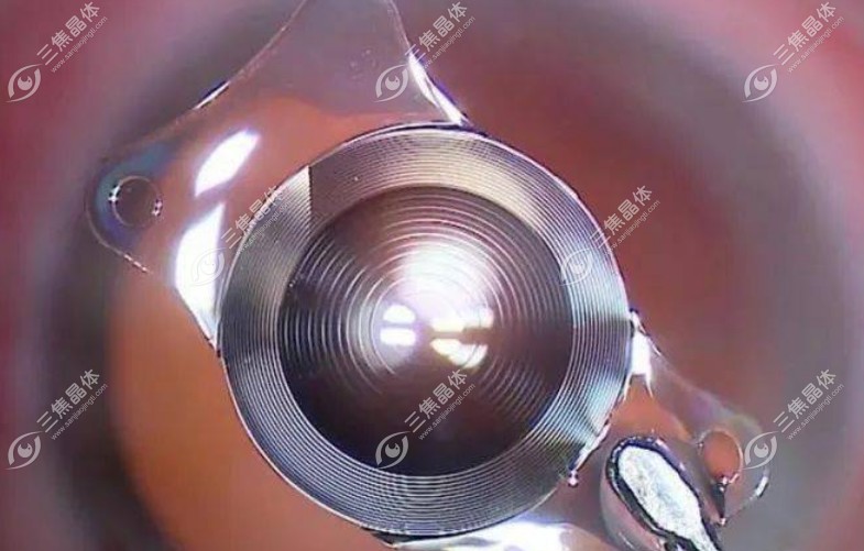 不同品牌的三焦晶体费用一般在：26000-35000元左右。