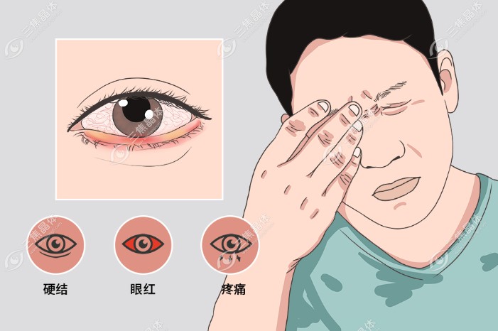 长时间眼内注油