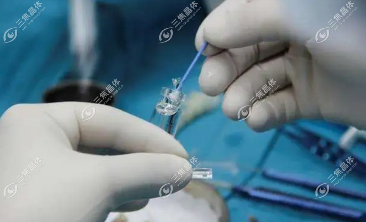 眼力健zxr00和zlb00人工晶体