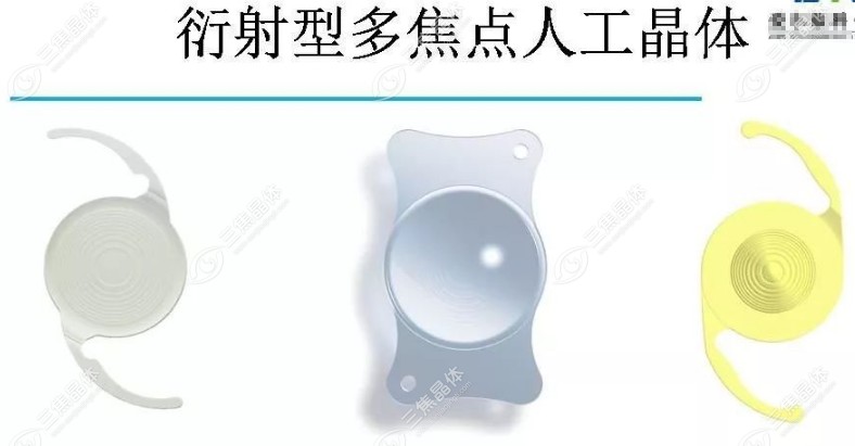 衍射型人工晶体与折射型人工晶体的区别介绍