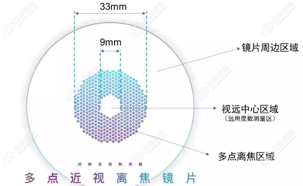 周边离焦镜片和多点离焦镜片的设计原理不同www.sanjiaojingti.com