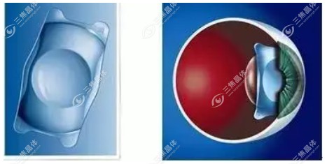 新无极连续视程人工晶体价格