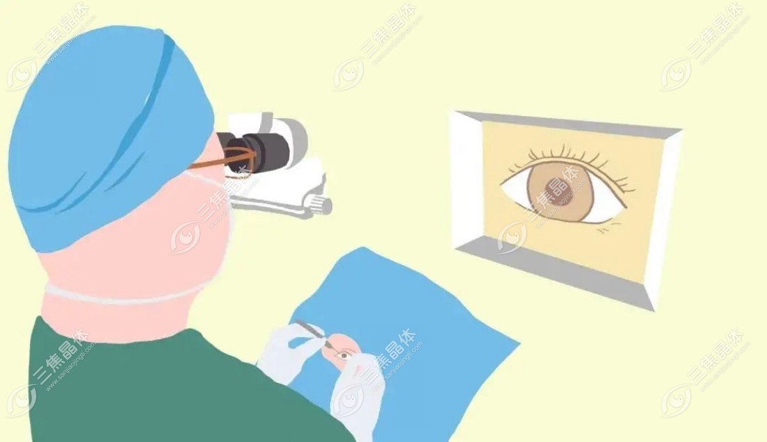 近视眼手术费用的组成部分www.sanjiaojingti.com
