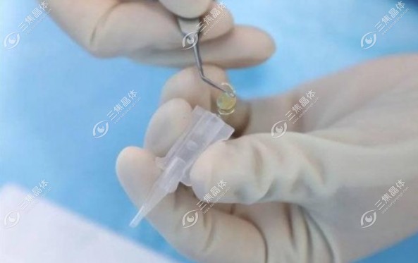 爱尔康三焦点人工晶体集采单价从此前的2.3万元降到不足9000元