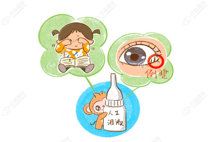 眼毛倒睫治疗方法