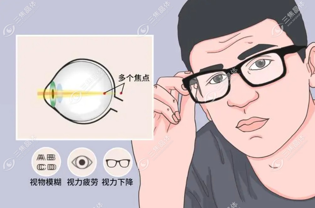 散光多少度不能做全飞秒手术www.sanjiaojingti.com
