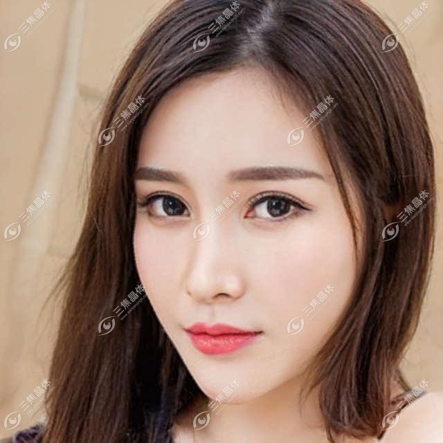 深圳市深圳新视代眼科医院近视手术费用详解？全飞秒近视矫正约1.5W+ / ICL晶体植入2.5W+ / 准分子激光近1W+