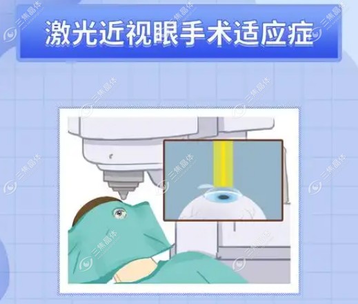 上海长庚眼科近视矫正价格