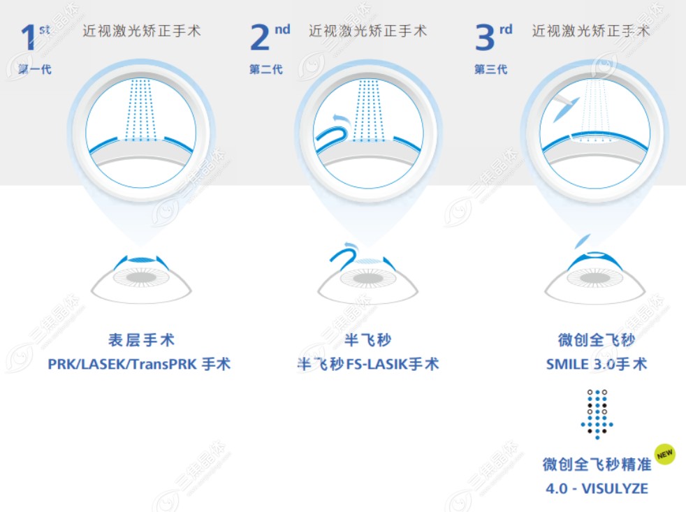 北京何氏眼科准分子激光项目价格