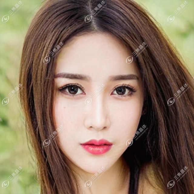 成都新视界眼科全项目价格表：半飞秒/全飞秒近视矫正+散光治疗+TICL/ICL晶体植入费用详解