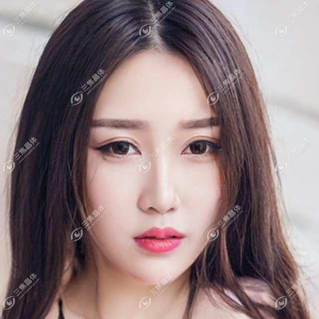 天津南开首爱眼科价格表一览，近视矫正8000+白内障手术12000+激光去斑5000+干眼治疗3000+